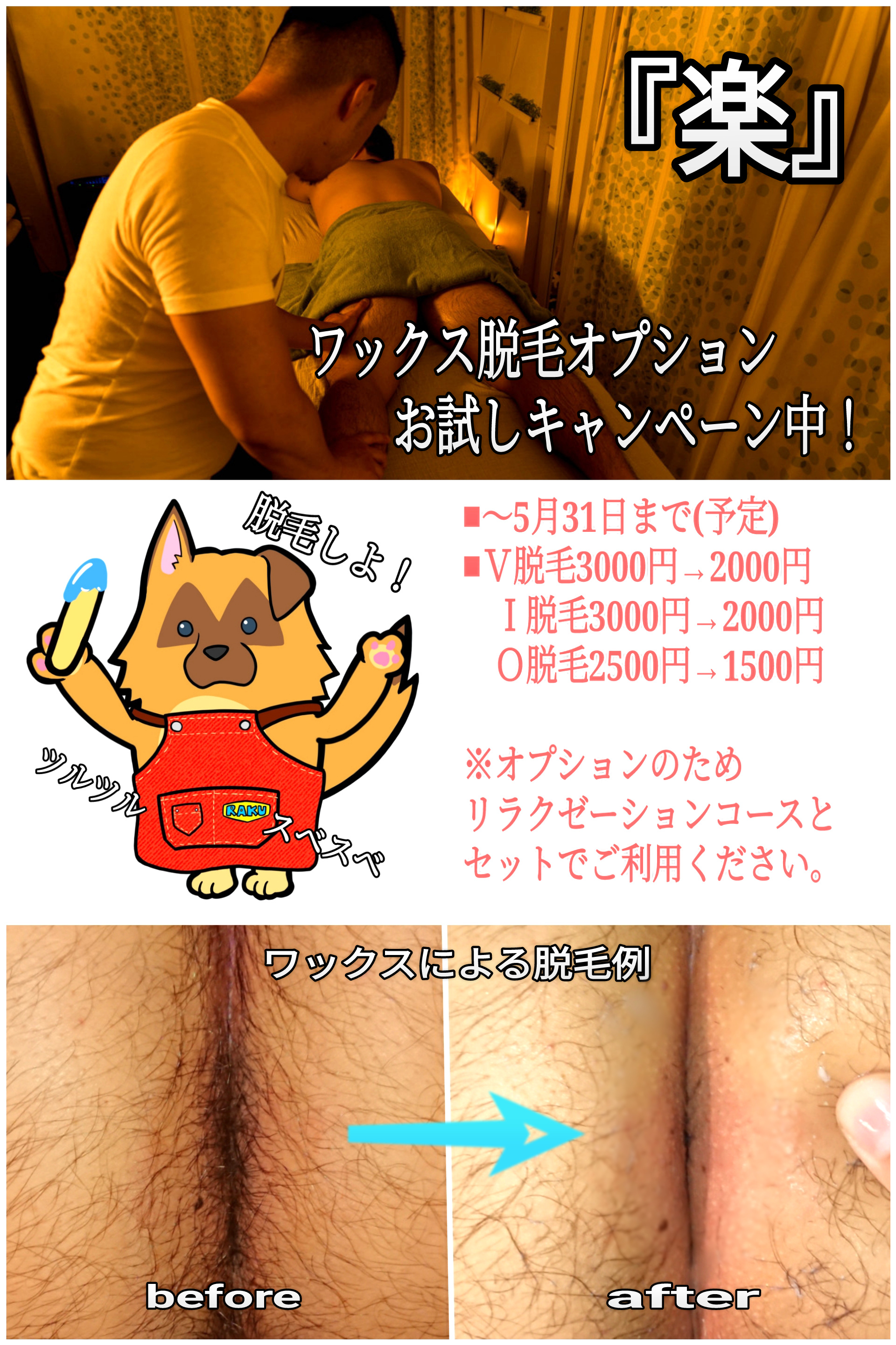 『楽』ワックス脱毛オプションお試しキャンペーン中！