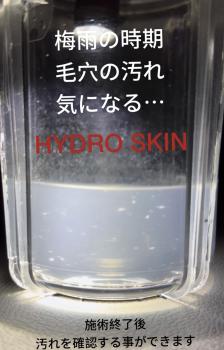 (大阪) 梅雨の時期の[毛穴対策] 1回単発利用もOK 1126x1759 353kb